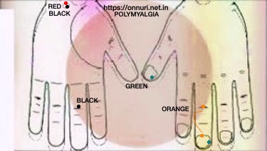 Using color with a permanent marker can help with syndromes by addressing the organic relationship between affected parts and meridians.